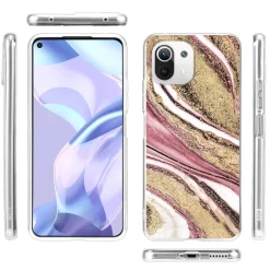 Xiaomi Mi 11 Lite 4G/5G - Marmor & Sand Design Hülle