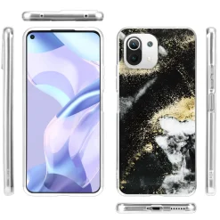 Xiaomi Mi 11 Lite 4G/5G - Marmor & Sand Design Hülle