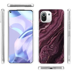 Xiaomi Mi 11 Lite 4G/5G - Marmor & Sand Design Hülle
