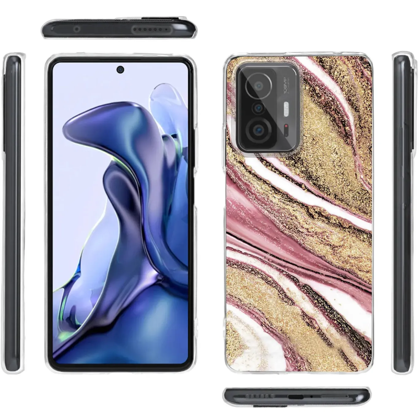 Xiaomi Mi 11T / Mi 11T Pro - Marmor & Sand Design Hülle